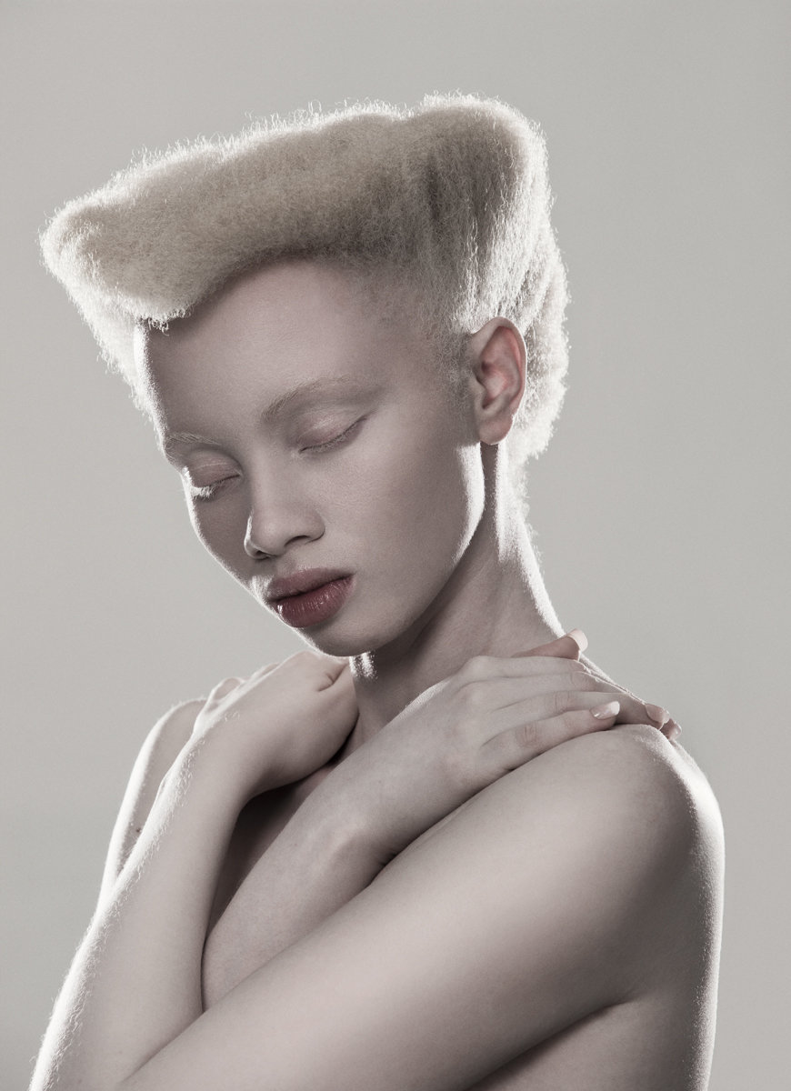 albino photography (1)
