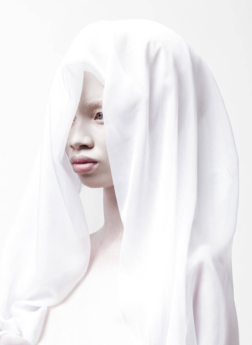 albino photography (2)