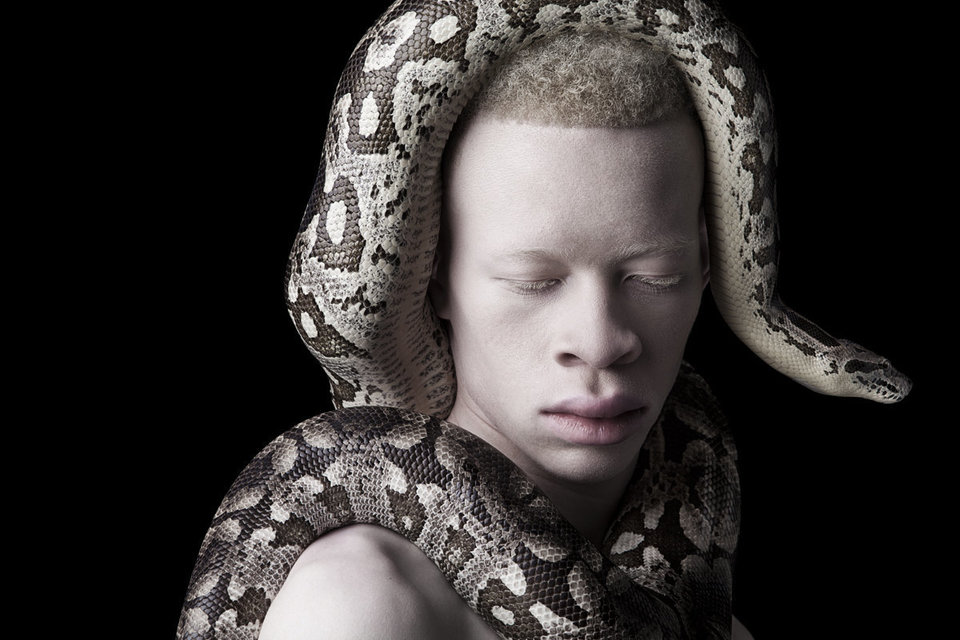 albino photography (3)