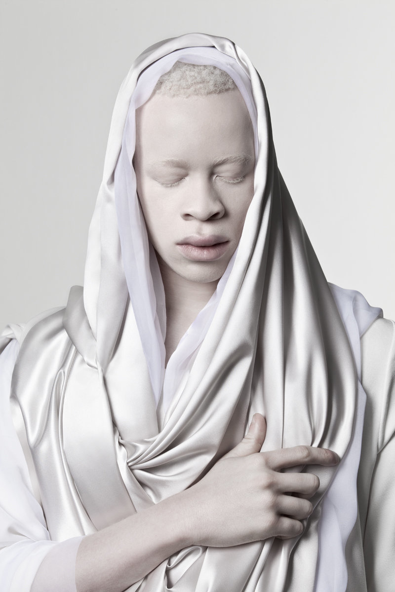 albino photography (5)