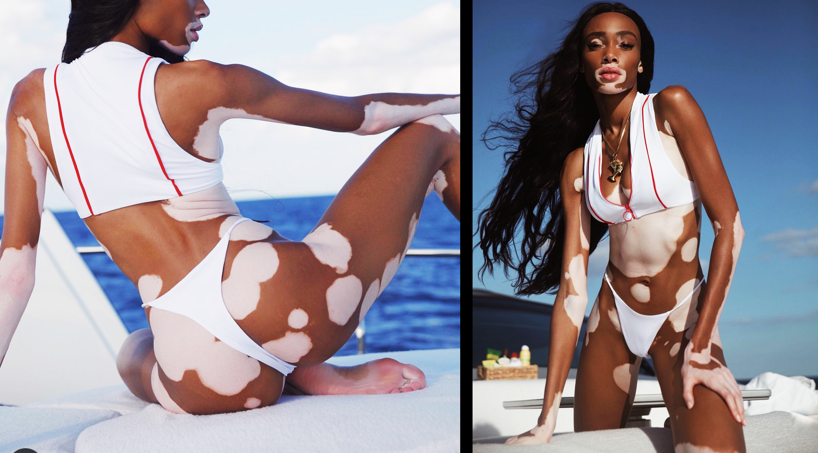 Winnie Harlow Sexy